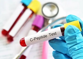 C-Peptide چیست؟