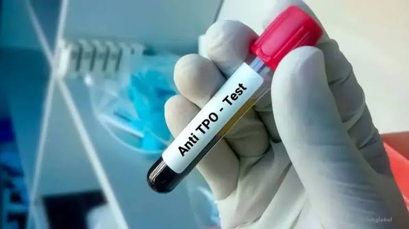 آزمایش Anti-TPO چیست؟